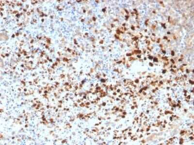 Immunohistochemistry-Paraffin: Herpes Simplex Virus 1 Antibody - Azide and BSA Free [NBP3-08600] - Formalin-fixed, paraffin-embedded human Cervix stained with Herpes Simplex Virus 1 Rabbit Polyclonal Antibody.